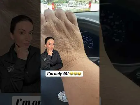7 navad, zaradi katerih se vaše roke starajo hitreje kot bi si želeli