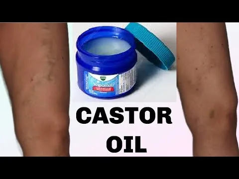 Domača krema proti pajkastim in krčnim žilam: naravna rešitev za bolj gladke noge z Vicks Vaporub!