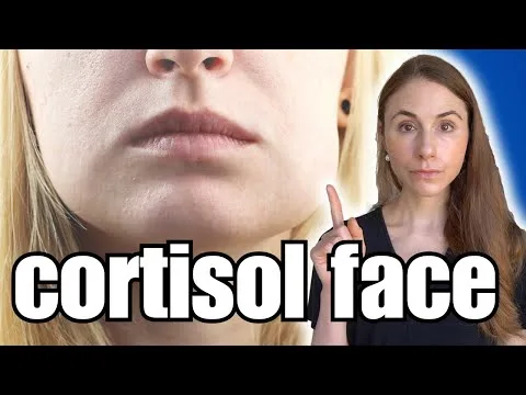 Ne staranje – stres uničuje kolagen: kaj je »cortisol face« in 5 načinov, kako to ustaviti