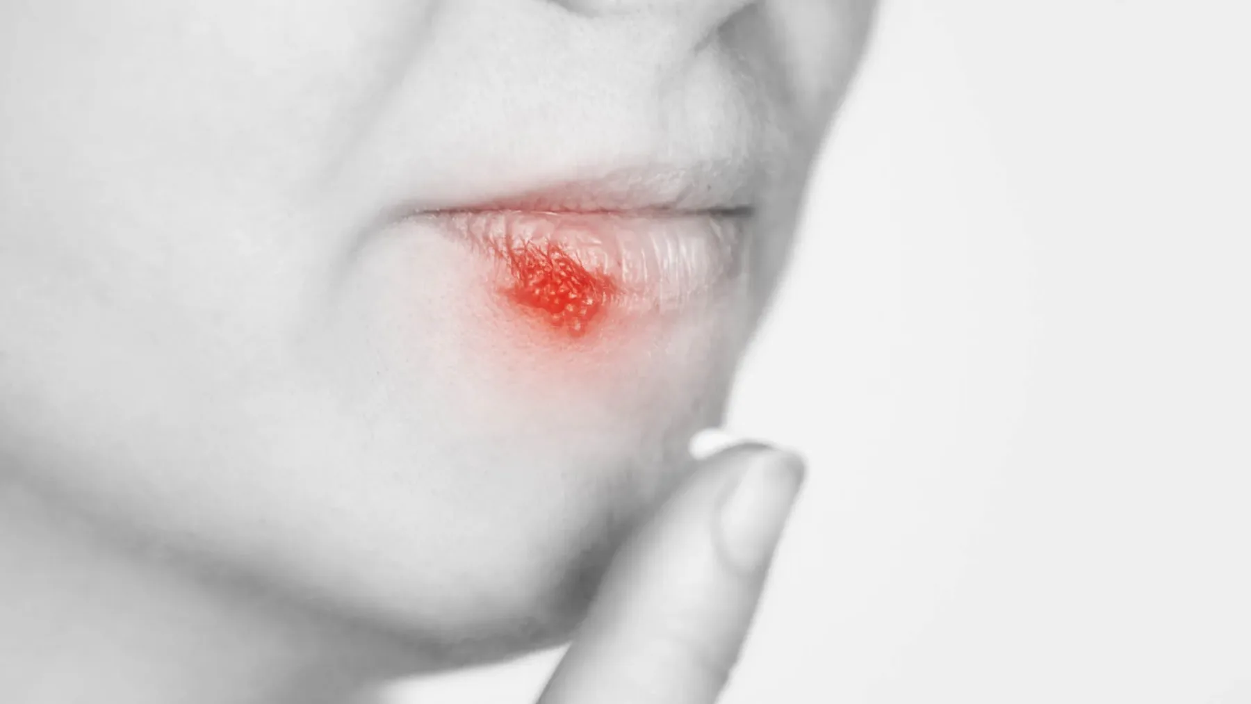 Se vam dela herpes? Če naredite TO, se sploh ne bo razvil (ustavite ga v 24 urah!)