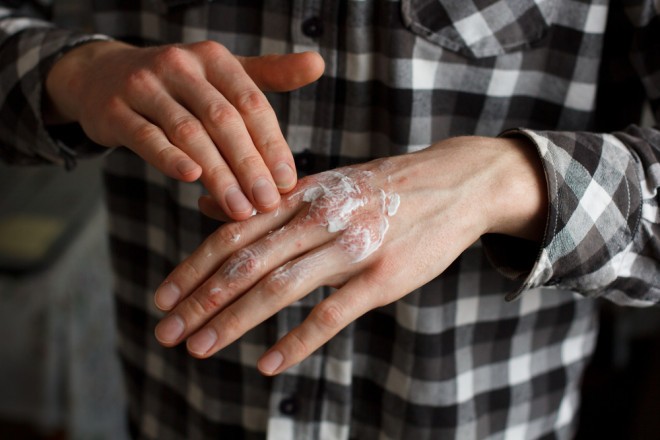 Lascia che la crema per le mani fatta in casa ti aiuti con la pelle secca delle mani.