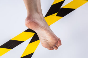 učinkovito zdravljenje glivic na nogah