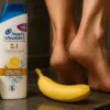 Recept domačo kremo proti glivicam